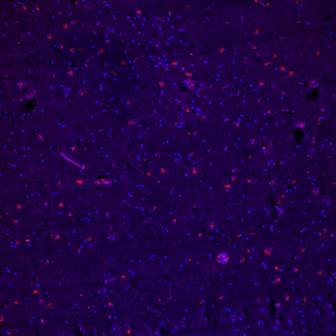 Brain_#42-15_dopamine receptor (rab_green)+CD34(mouse-red)_x20_3
